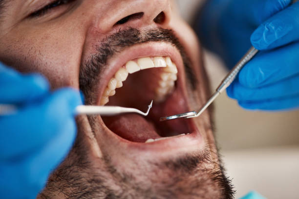 Best Dentist for Severe Toothache  in Beverly, OH